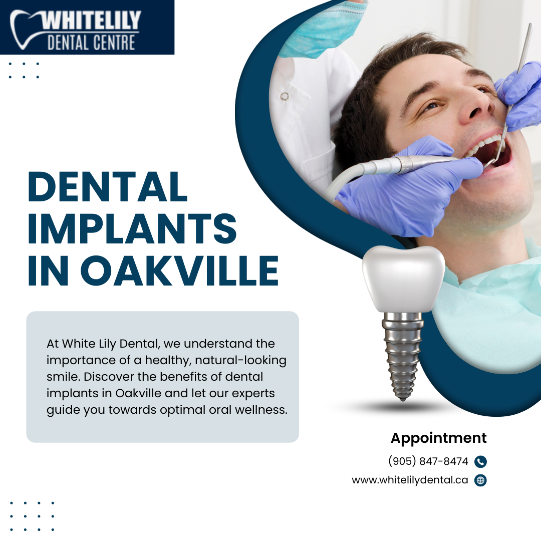 White Lily Dental - Dental Implants